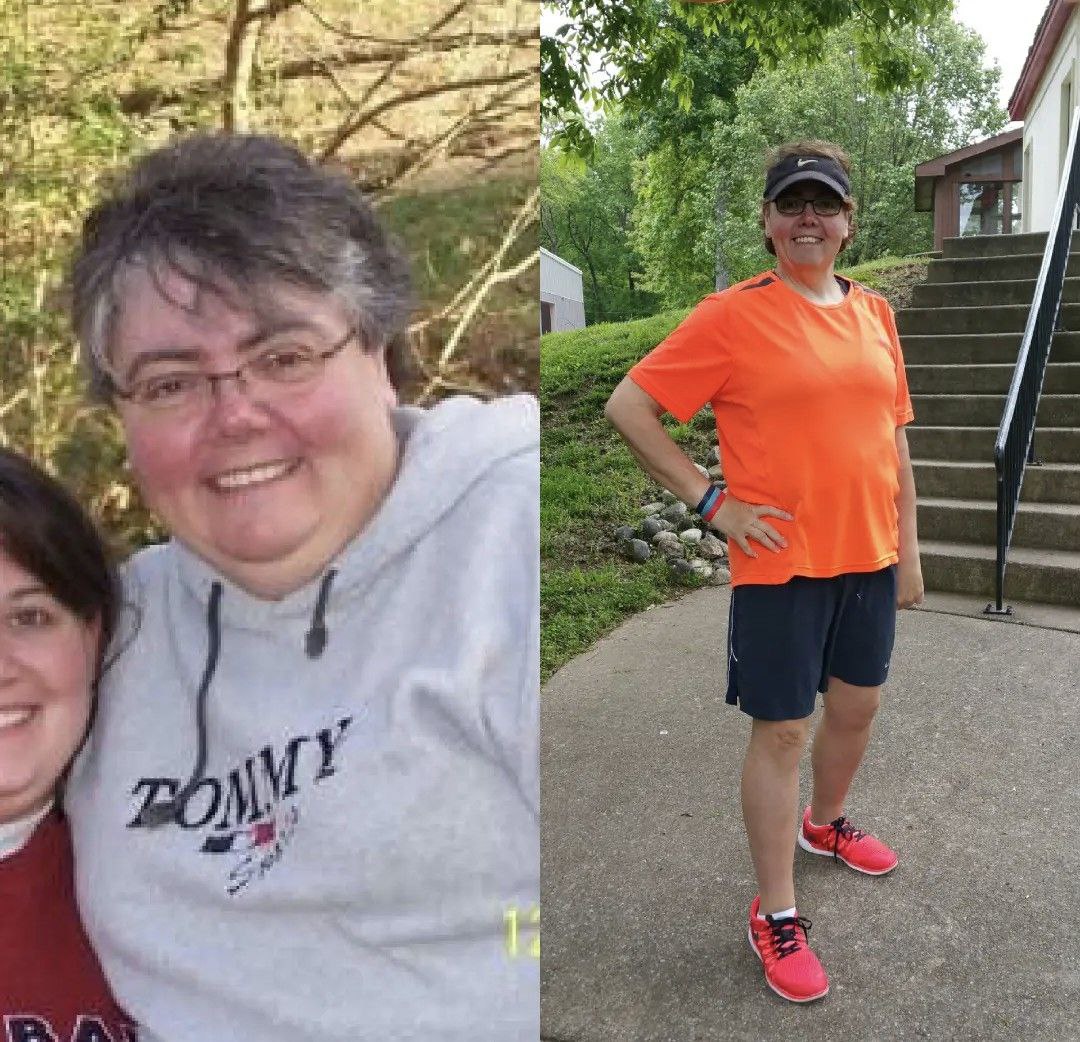 Cindy, before and after